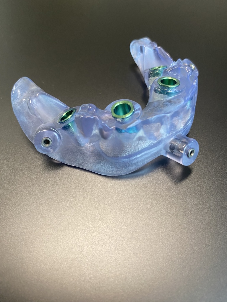 DGRX Surgical Guide Plan